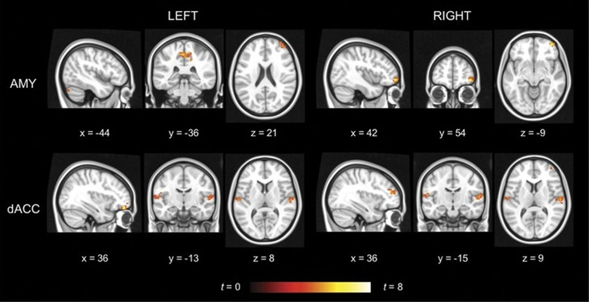 Pigułka antykoncepcyjna a mózg: nowe badania ujawniają zaskakujące fakty - image 1