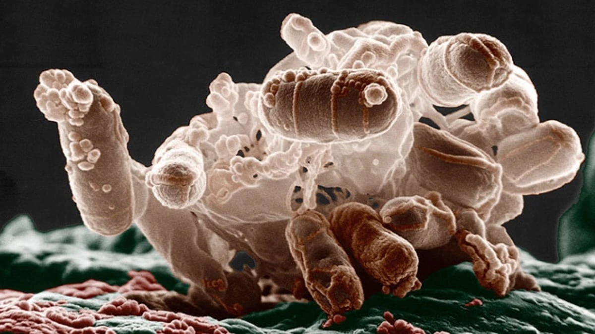 Dlaczego niektóre antybiotyki mogą nasilać stan zapalny podczas infekcji