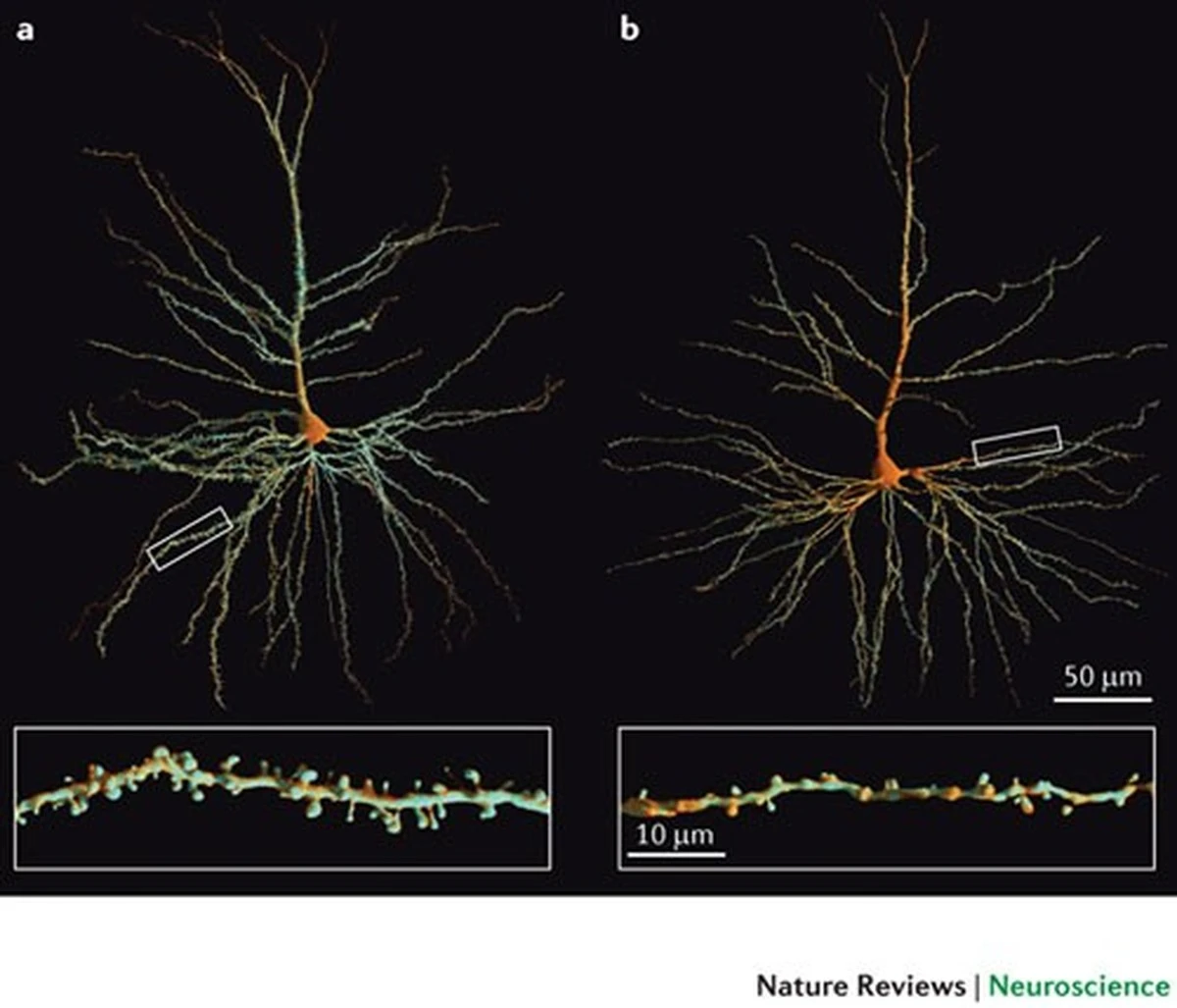 Dlaczego mózg po pięćdziesiątce przestaje sprzątać białkowe śmieci - image 1