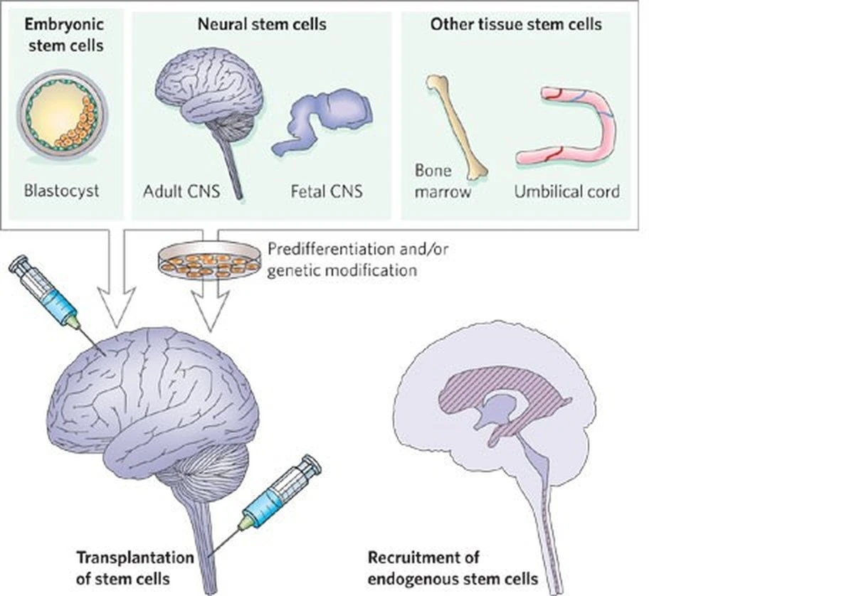 dlaczegojaponsc-extra-1.webp Dlaczego japońscy lekarze zaczęli wszczepiać komórki macierzyste do mózgu i serca - image 1