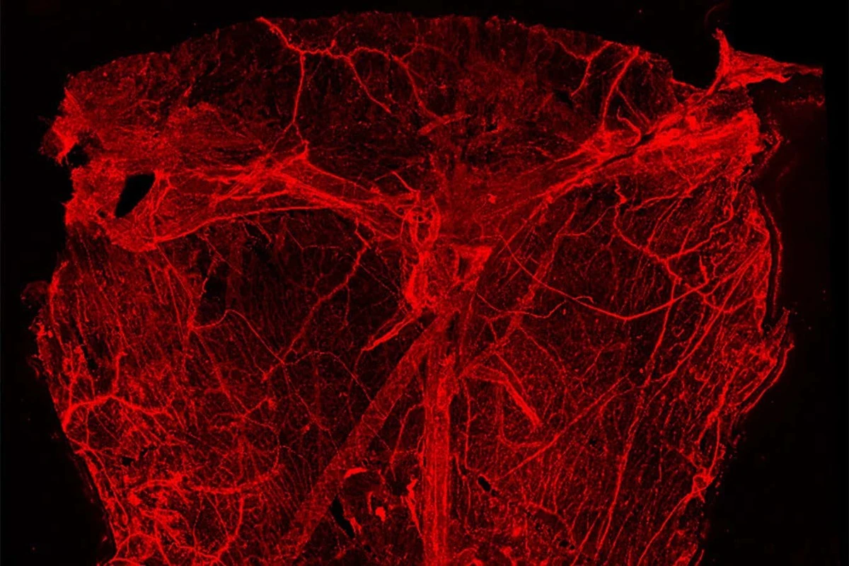 Nieznana sieć wewnątrz głowy: Harvard odkrył brakujący element