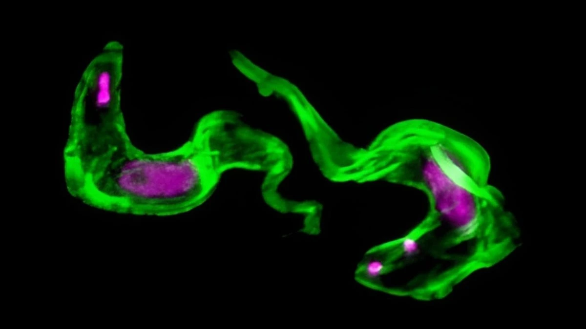 Jak pasożyt śpiączki przez 40 lat ukrywał swój podstępny mechanizm
