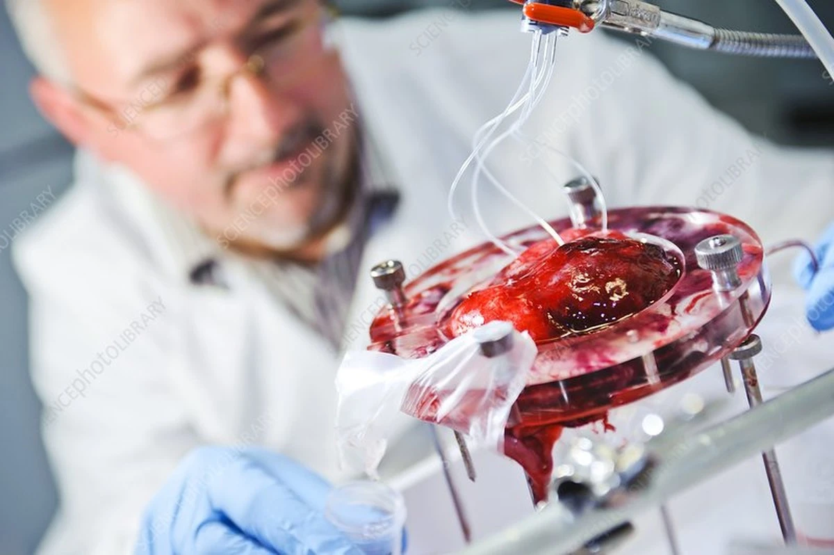 dlaczegonaukowc-extra-1.webp Dlaczego naukowcy radzą badać łożysko pod kątem ryzyka schizofrenii - image 1