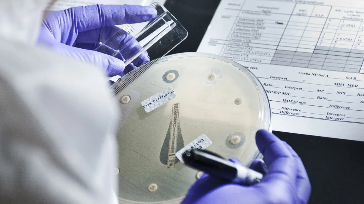 Dlaczego lekarze coraz częściej mówią o powrocie duru brzusznego - image 1