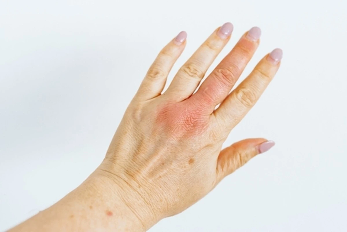 Opuchnięte palce po nocy? Ten jeden sygnał mówi, że czas udać się do lekarza