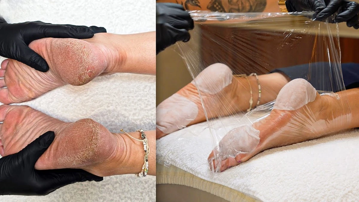 Dlaczego pumeks sprawia, że skóra na piętach staje się twardsza - image 1