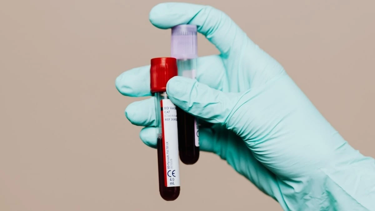 Prosty test krwi może wykryć Alzheimera na 20 lat przed objawami