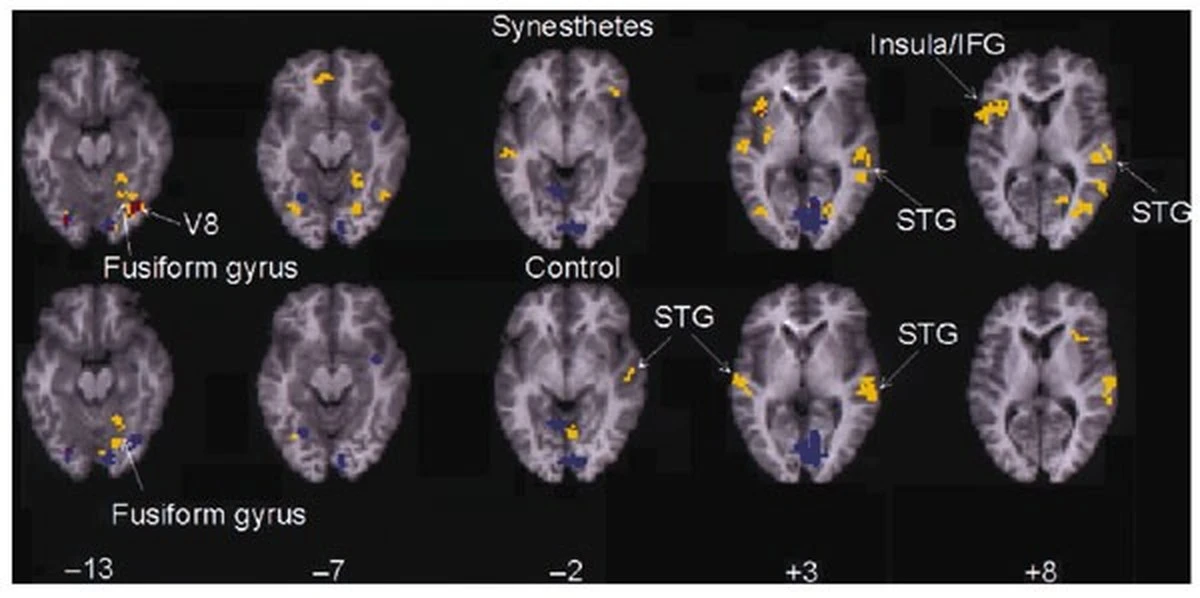 Dlaczego niektórzy ludzie „smakują” słowa lub widzą dźwięki w kolorach - image 1