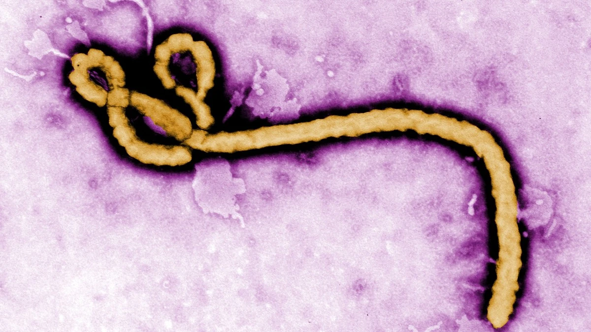 Dlaczego obecne szczepionki nie działają na wirusa Ebola - image 1