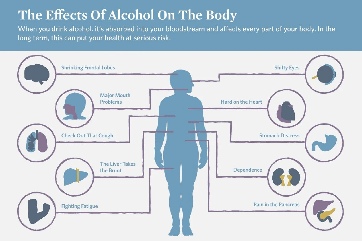Ten jeden rodzaj alkoholu niszczy żołądek najbardziej. I wcale nie chodzi o tanie wino - image 1