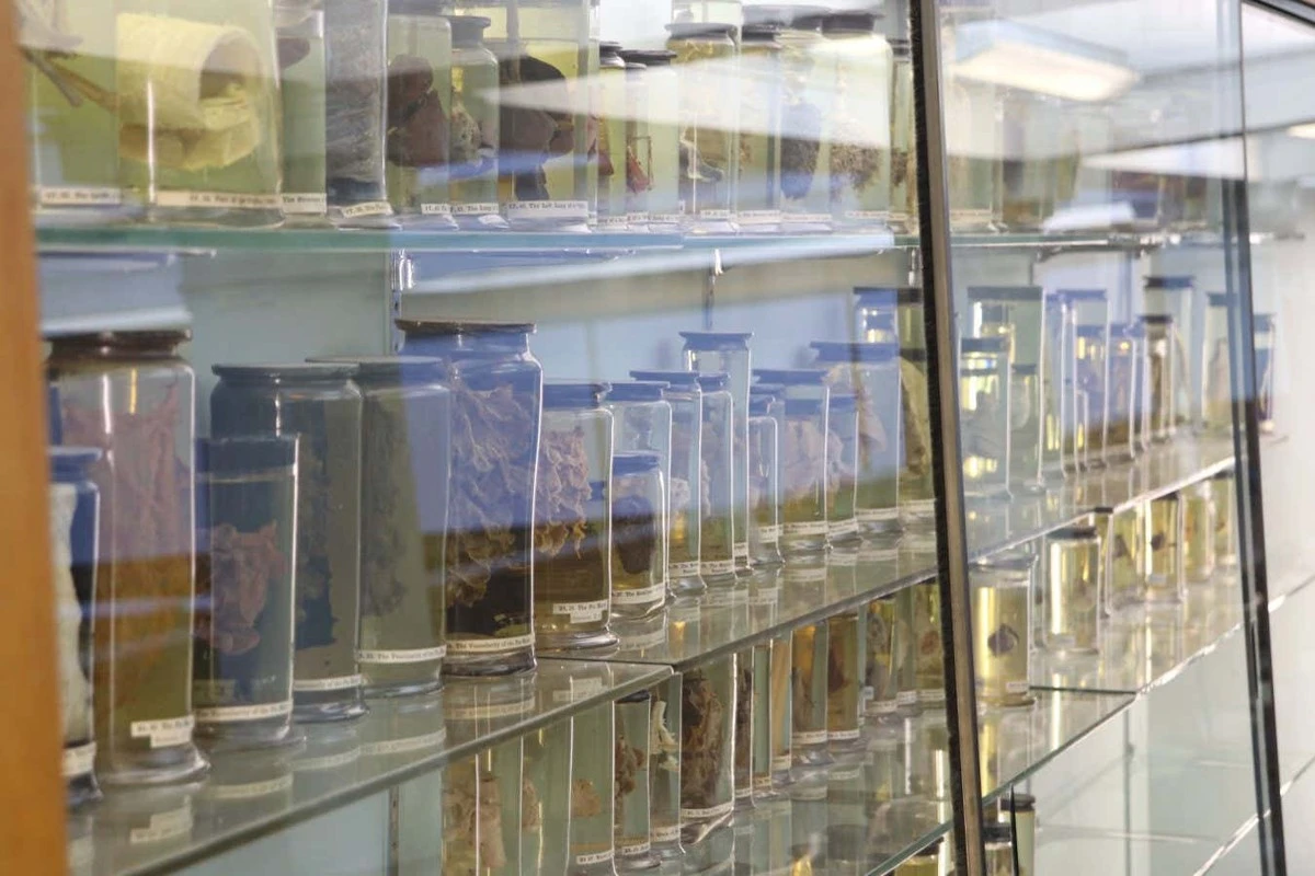 Co zawierały płuca kobiety z XVIII wieku? To odkrycie zmienia wszystko