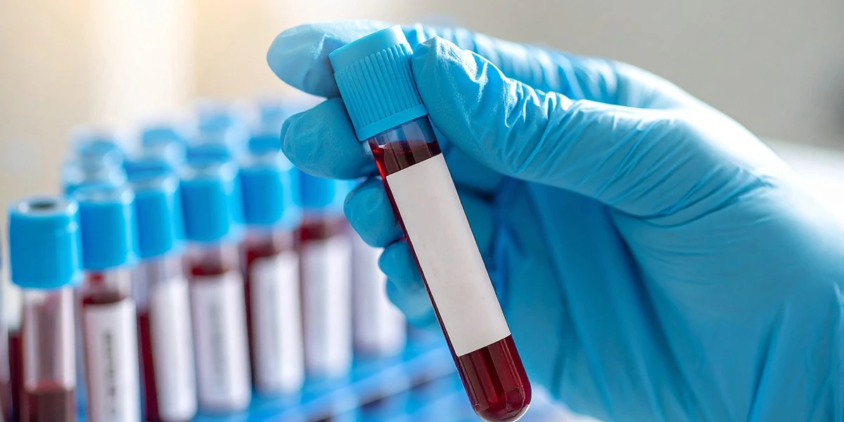 Ten jeden wskaźnik we krwi może zdradzić ryzyko demencji na dekady przed diagnozą - image 1