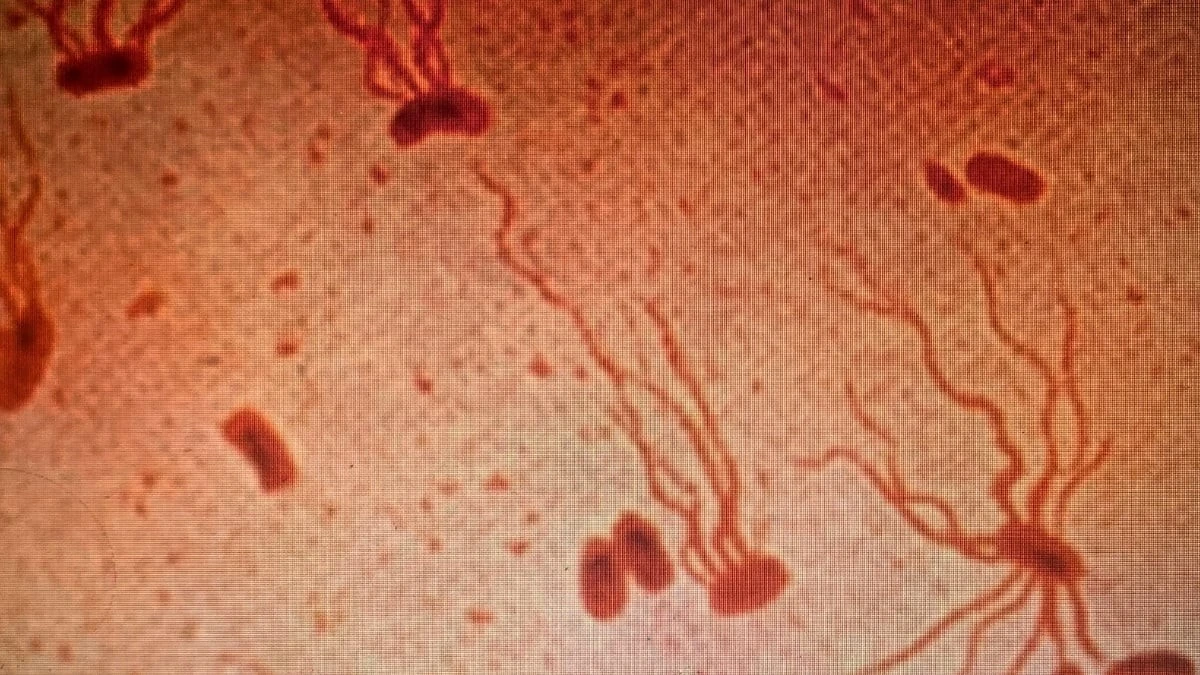 Dlaczego antybiotyki, które trzymasz w apteczce, mogą przestać działać