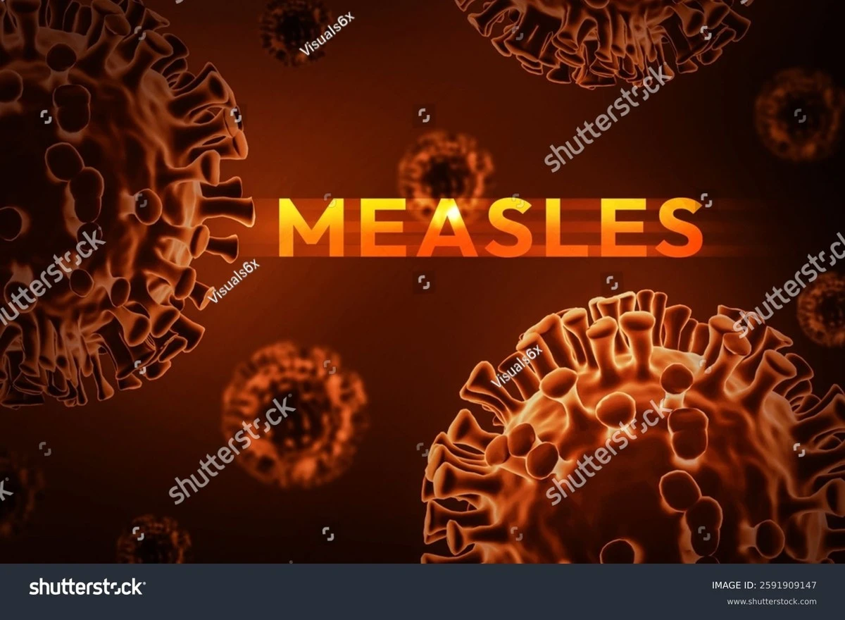 Wirus Ebola: dlaczego ten wybuch różni się od wszystkich poprzednich - image 1