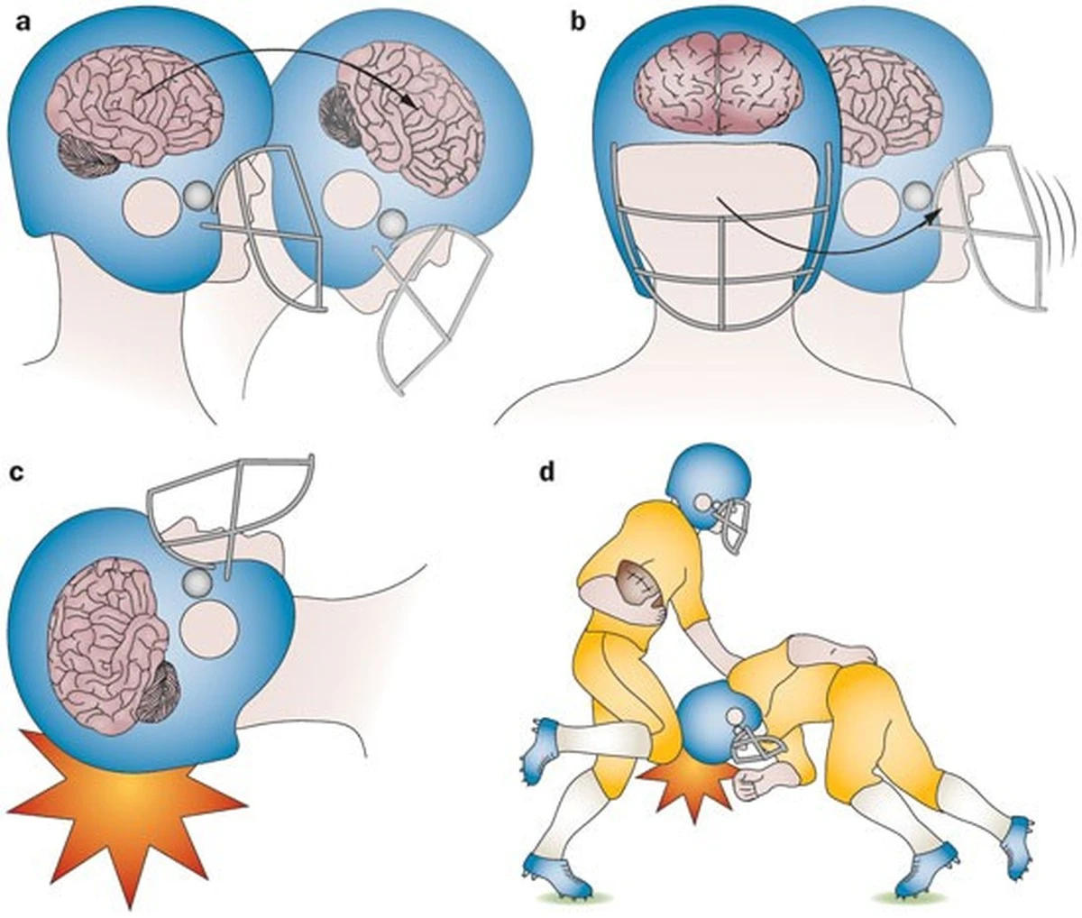 Dlaczego bariera krew-mózg u sportowców staje się nieszczelna - image 1