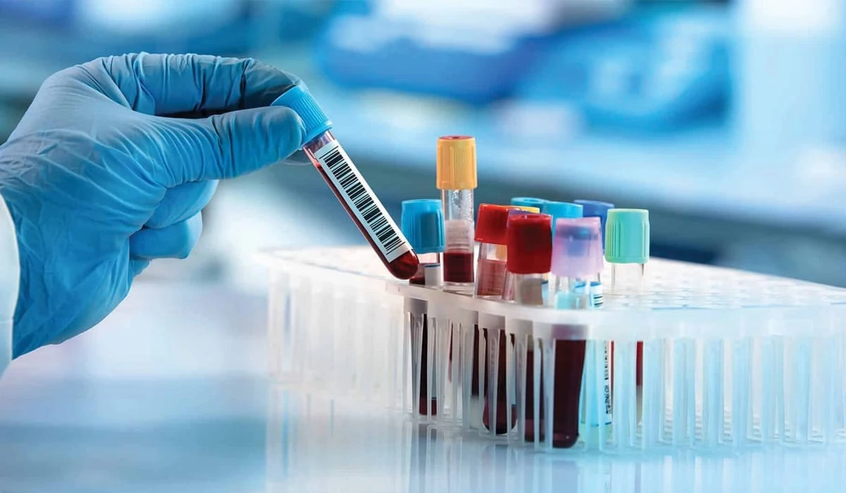 Dlaczego naukowcy badają teraz u kobiet poziom białka p-tau217 we krwi - image 1