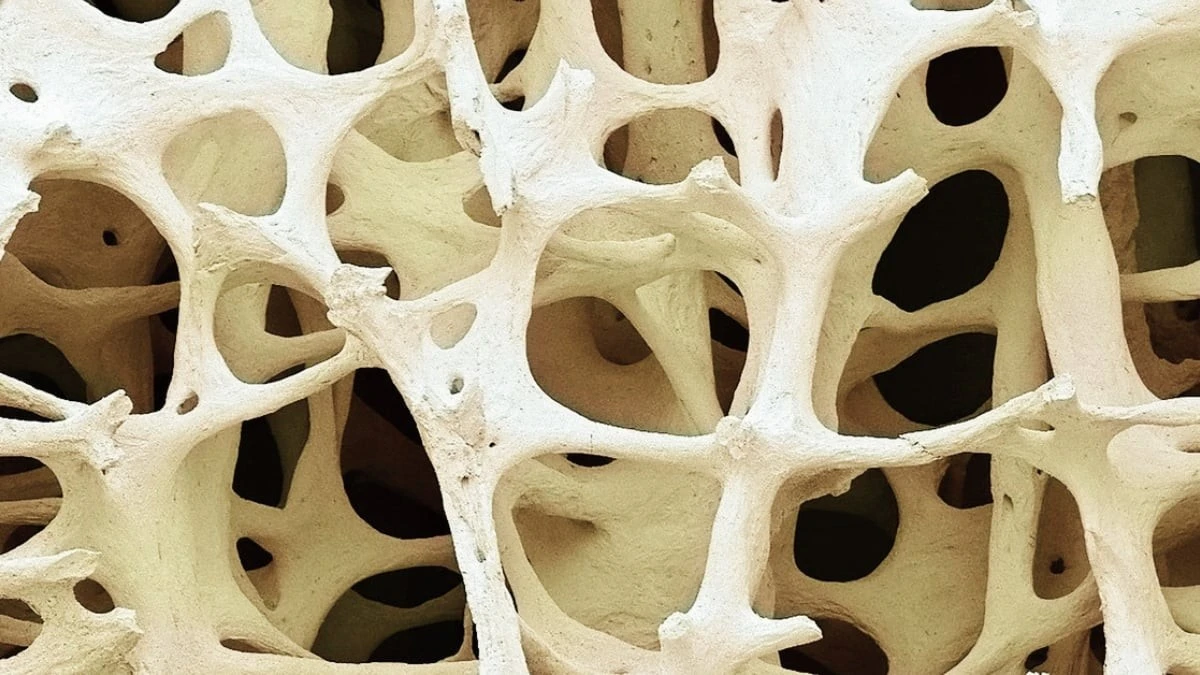 Osteopenia: cichy sygnał, którego nie warto ignorować po czterdziestce